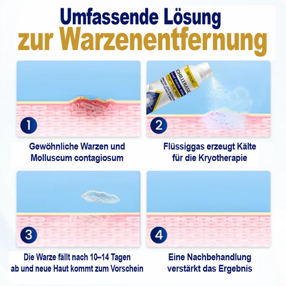 GFOUK® ChillErase Spray zur Pickel- und Hauterneuerung