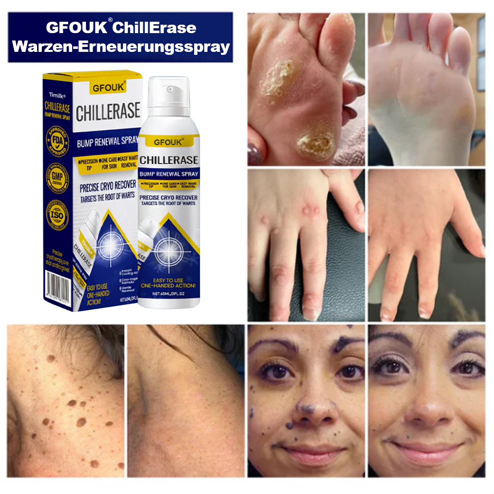 GFOUK® ChillErase Spray zur Pickel- und Hauterneuerung