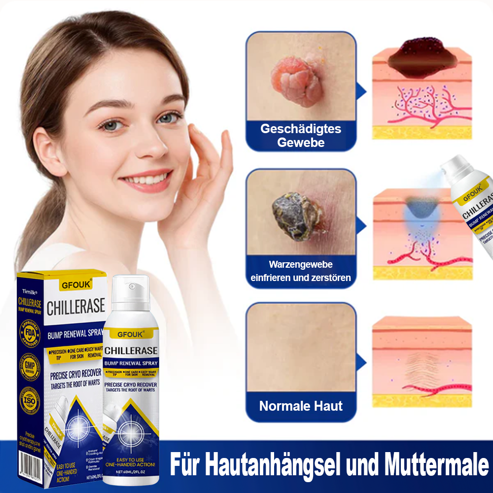 GFOUK® ChillErase Spray zur Pickel- und Hauterneuerung