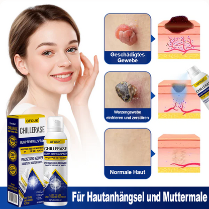 GFOUK® ChillErase Spray zur Pickel- und Hauterneuerung